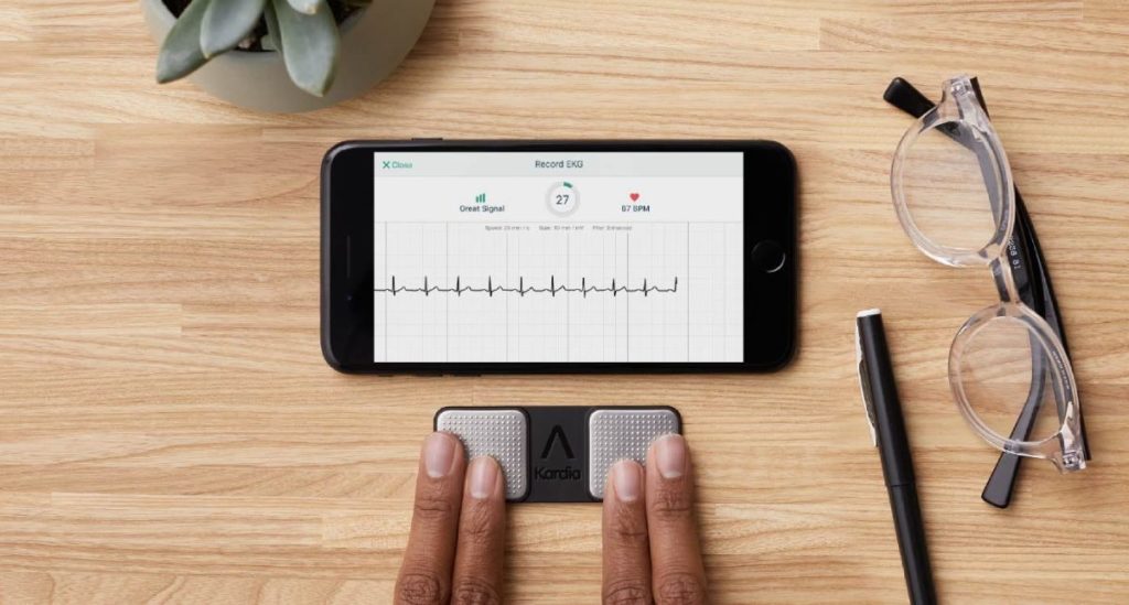 AliveCor EKG