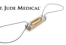 St. Jude Medical completes its acquisition of CardioMEMS St. Jude Medical completes its acquisition of CardioMEMS