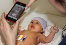 New mobile app that can detect newborn jaundice in minutes BiliCam