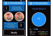 A couple of Australian med students invents an app that screens for anaemia Eyenaemia app
