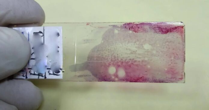 GettyImages-1342440278_pathologyslide.16x9-1536x864