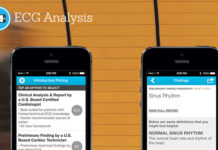 Three separate studies demonstrate accuracy of the AliveCor Heart Monitor AliveCor Heart Monitor