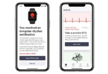 Apple, J&J to study whether Apple Watch can reduce the risk of stroke Apple Heartline study