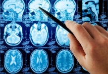 Enlitic wants to help doctors analyze images with deep learning Enlitic wants to help doctors analyze images with deep learning