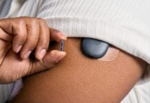 Senseonics tests a one-year CGM with no wearable transmitter Senseonics tests a one-year CGM with no wearable transmitter