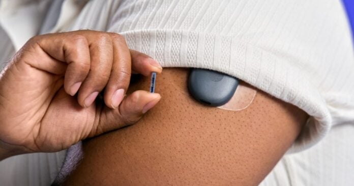 Senseonics tests a one-year CGM with no wearable transmitter Senseonics tests a one-year CGM with no wearable transmitter