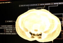 Midjourney is building a full-body ultrasound scanner and spas to put them in