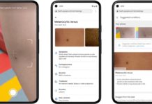 Google demos an AI-powered dermatology assist tool Using AI to help find answers to common skin conditions